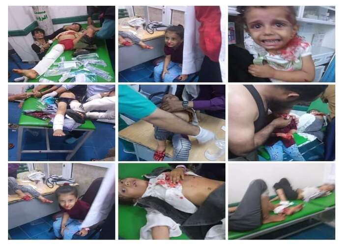 تعز: إصابة 12 طفلاً بقصف حوثي استهدف حي الروضة