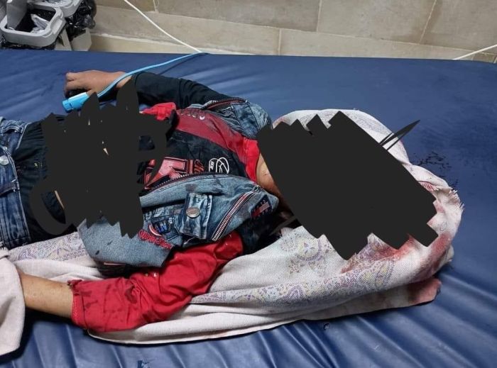 مقتل طفل برصاص مسلحين في محافظة إب