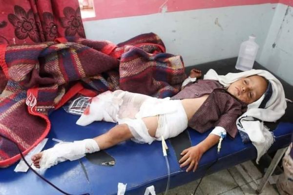 مليشيات الحوثي ترتكب مجزرة في حي سكني بمدينة تعز